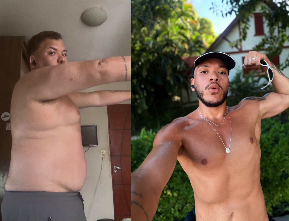 Antes e depois — resultado real